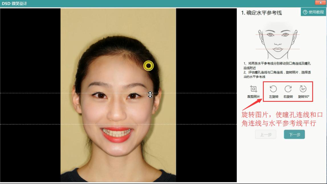 评估瞳孔连线与口角连线